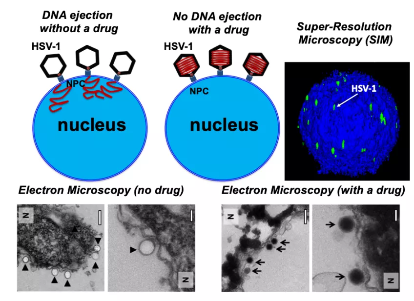 Graphical representation and electron microscopy images of the effects of our antiviral compounds on inhibiting DNA ejection from the virus into the nucleus. 